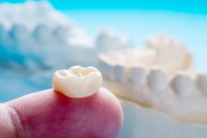 Дефект коронковой части зуба