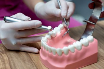 Протезирование жевательных зубов нижней челюсти