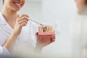 Для сомневающихся: стоит ли ставить импланты зубов