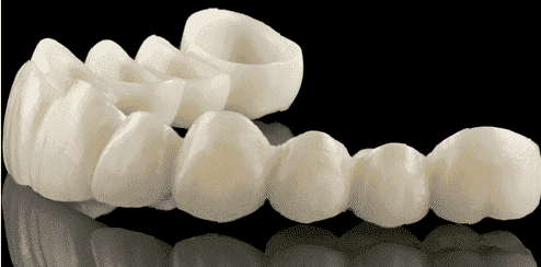 Как протезируют передние зубы