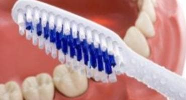 Как ухаживать за металлокерамическими зубами?
