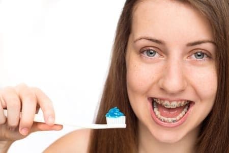 Нужна ли специальная зубная паста для брекетов?