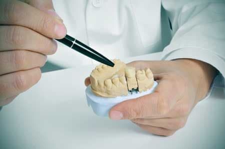 Как происходит процесс изготовления зубных протезов