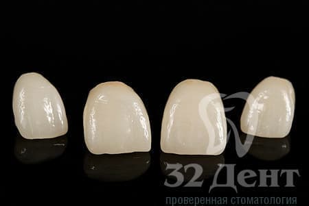 фарфоровые коронки