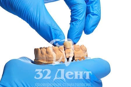 поставить коронку на зуб