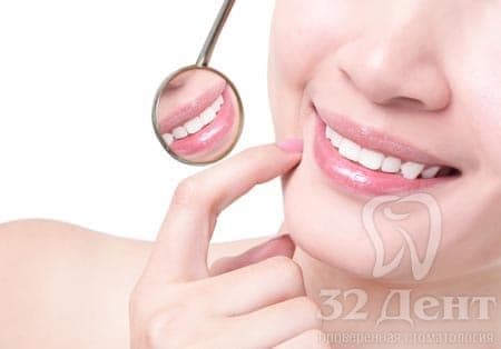 Реставрационное отбеливание зубов
