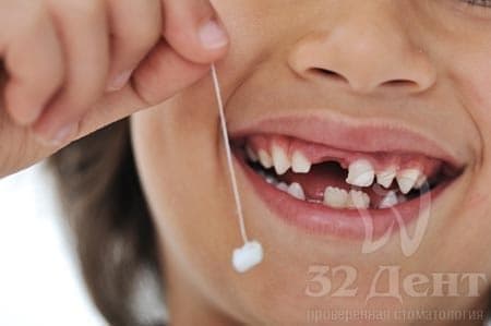 Возможна ли замена всех зубов на импланты