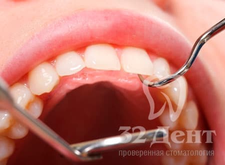 заболевания пародонта