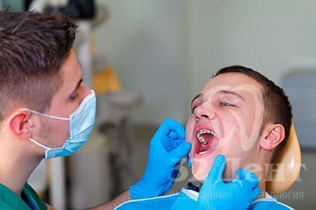 Удаление зубов по ортодонтическим показаниям