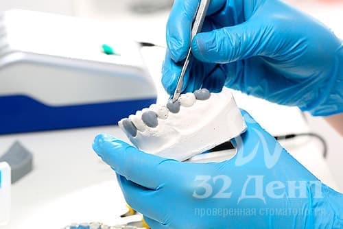 Протезирование жевательных зубов нижней челюсти