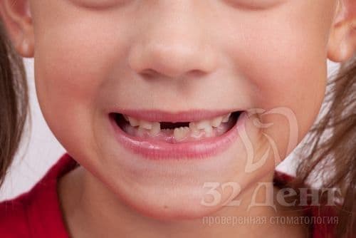 протезированию зубов у детей