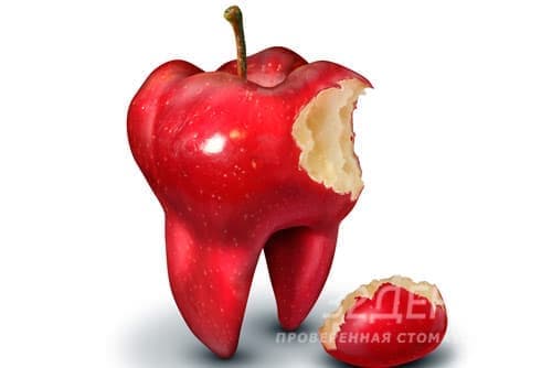 10 причин не откладывать лечение кариозных зубов