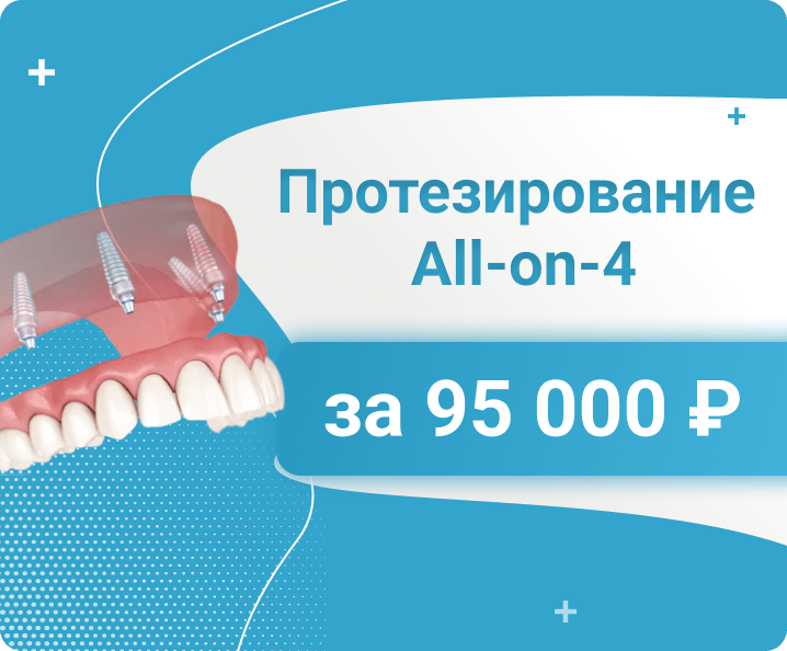 All-on-4/6 - Протезирование All-on-4 за 95 000 ₽