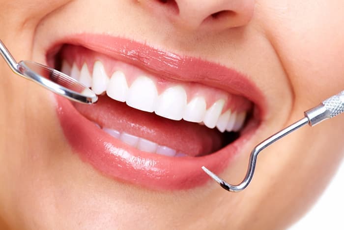 Этапы отбеливания зубов