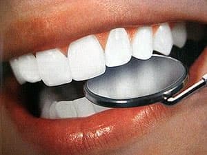 Вопросы и ответы по операции установки зубных имплантов
