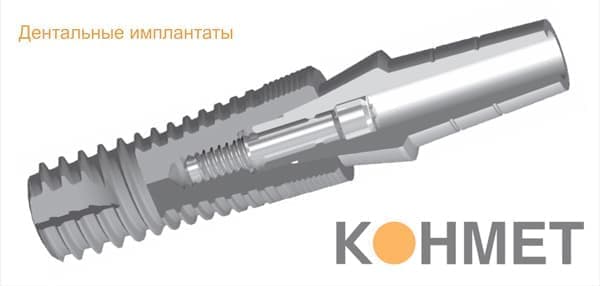 Импланты Конмет
