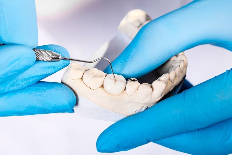 Выбор протезной зубной конструкции, ее типа, зависит от нескольких факторов: степени утраты зубов, состояния десен и, конечно, стоимости.