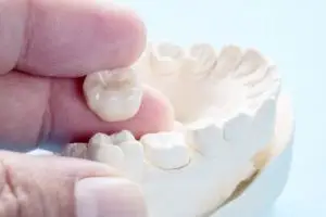 коронки из оксида циркония