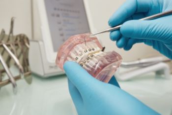 Классификация ортодонтических аппаратов
