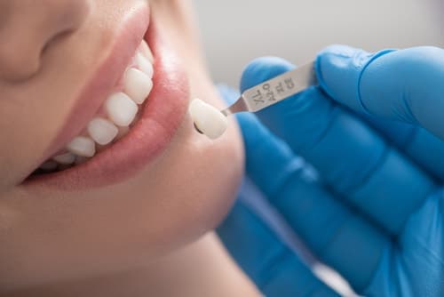 Выбор опорных зубов при протезировании 3