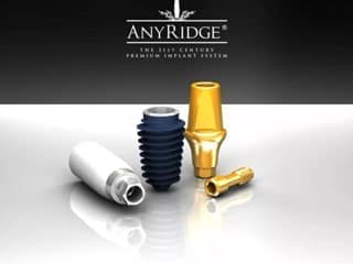 Импланты Anyridge