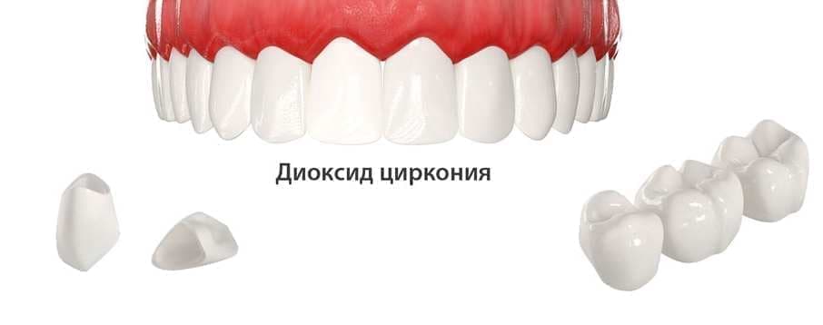 Циркониевые коронки