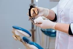 Протезирование зубов начинается с изготовление гипсового слепка челюсти.