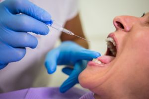 Поднялась температура после удаления зуба: возможные причины и рекомендации