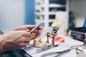 О сроках и этапах изготовления зубных протезов