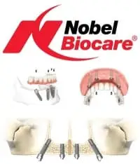 Импланты Nobel Biocare