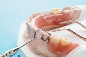 съемные нейлоновые зубные протезы