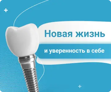 Имплантация зубов - Новая жизнь и увереность в себе