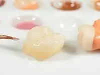 Срочное изготовление коронок за 1 день!