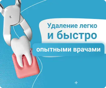 Удаление зубов - Удаление легко и быстро опытными врачами