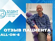 #32 Отзыв об имплантации зубов