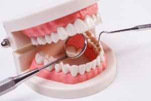 Дисколорит зубов